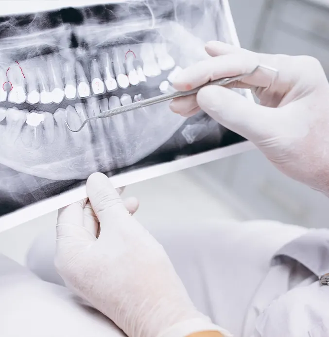 Endodoncia